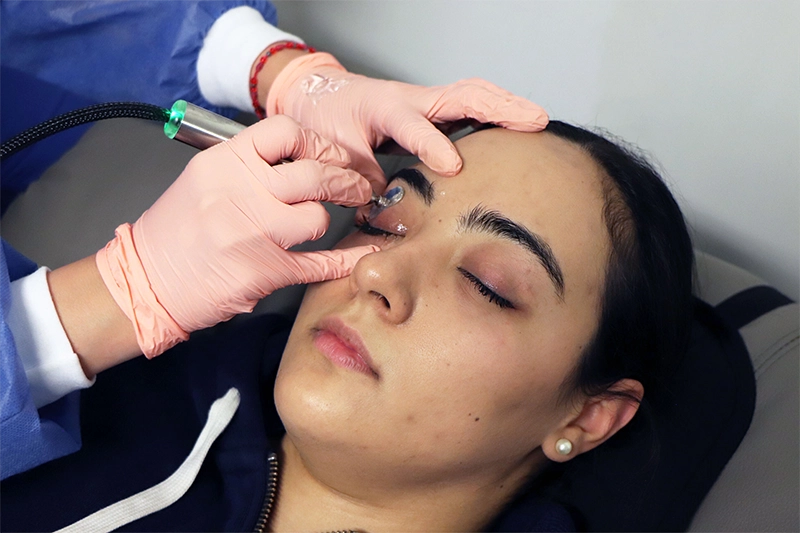 Tratamiento-Ojo-seco-NUEVO